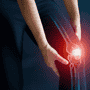 Revolucionando la salud articular: Terapia con células madre para la osteoartritis en la Clínica Vega de Bangkok, Tailandia