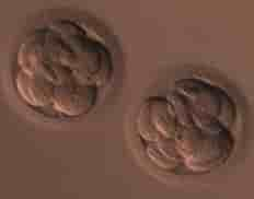 inSer - Human IVF and Fertility Center Reviews in Medellin,Bogota,Cali, Colombia Slider image 8