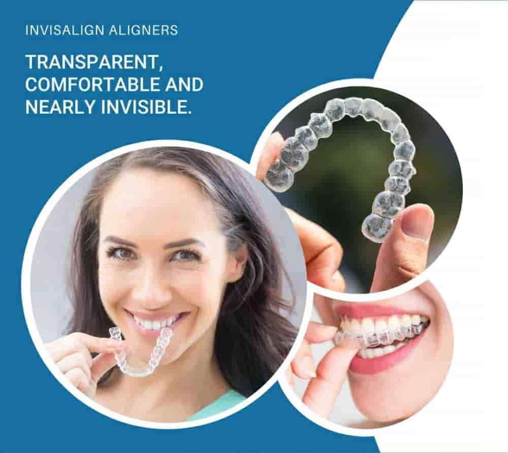 Dis 212 - Dental Aesthetics Facility en Istanbul, Turkey Reseñas de pacientes reales Slider image 8