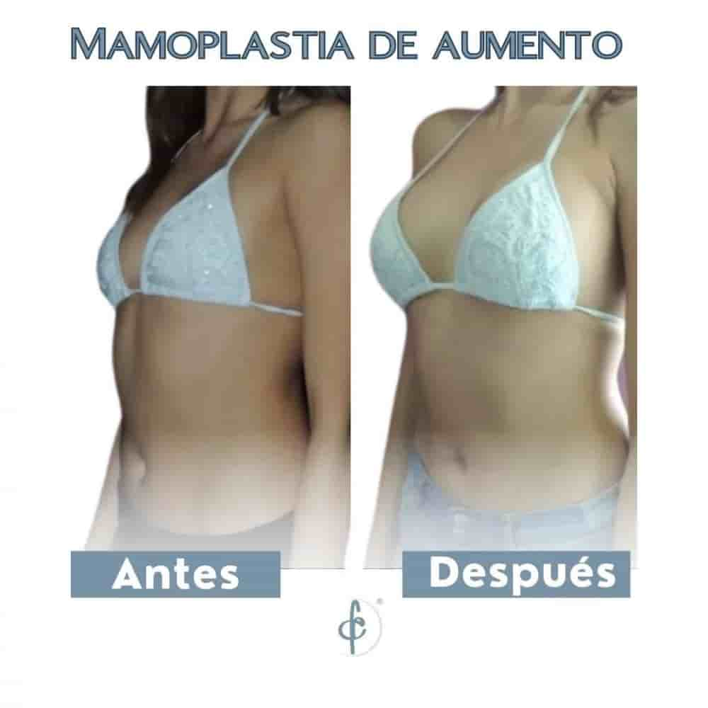 Dr. Felipe Castro Esguerra Plastic Surgery Reviews in Bogota, Colombia Slider image 2