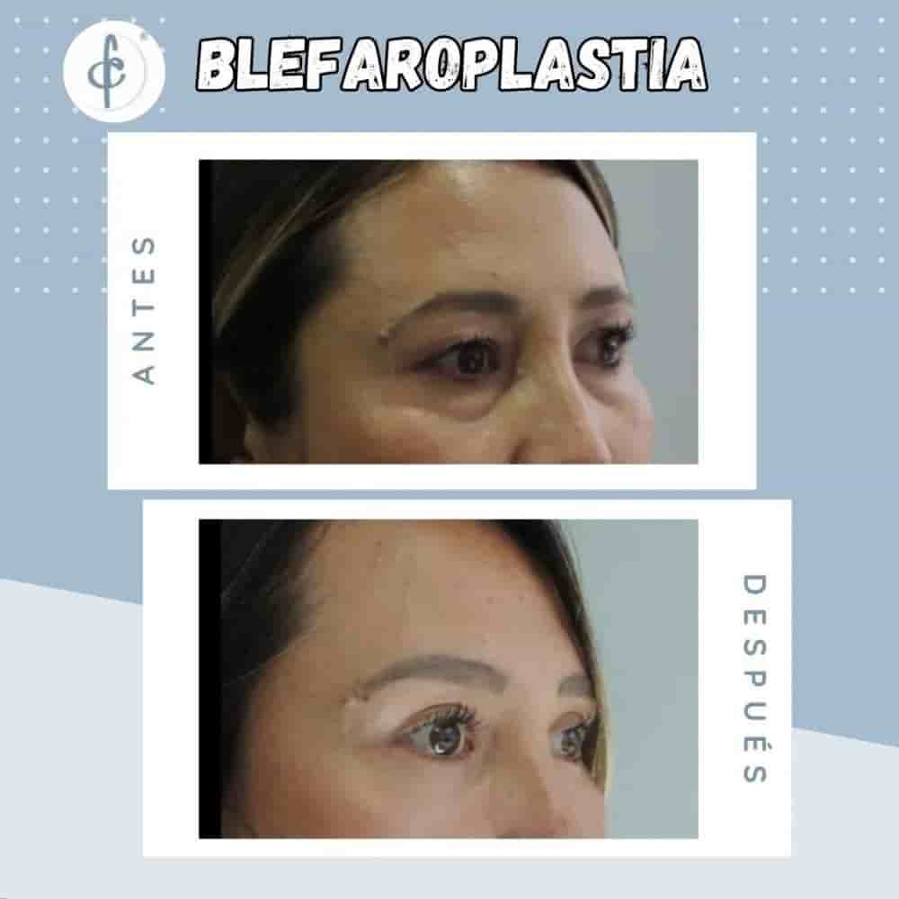 Dr. Felipe Castro Esguerra Plastic Surgery Reviews in Bogota, Colombia Slider image 3