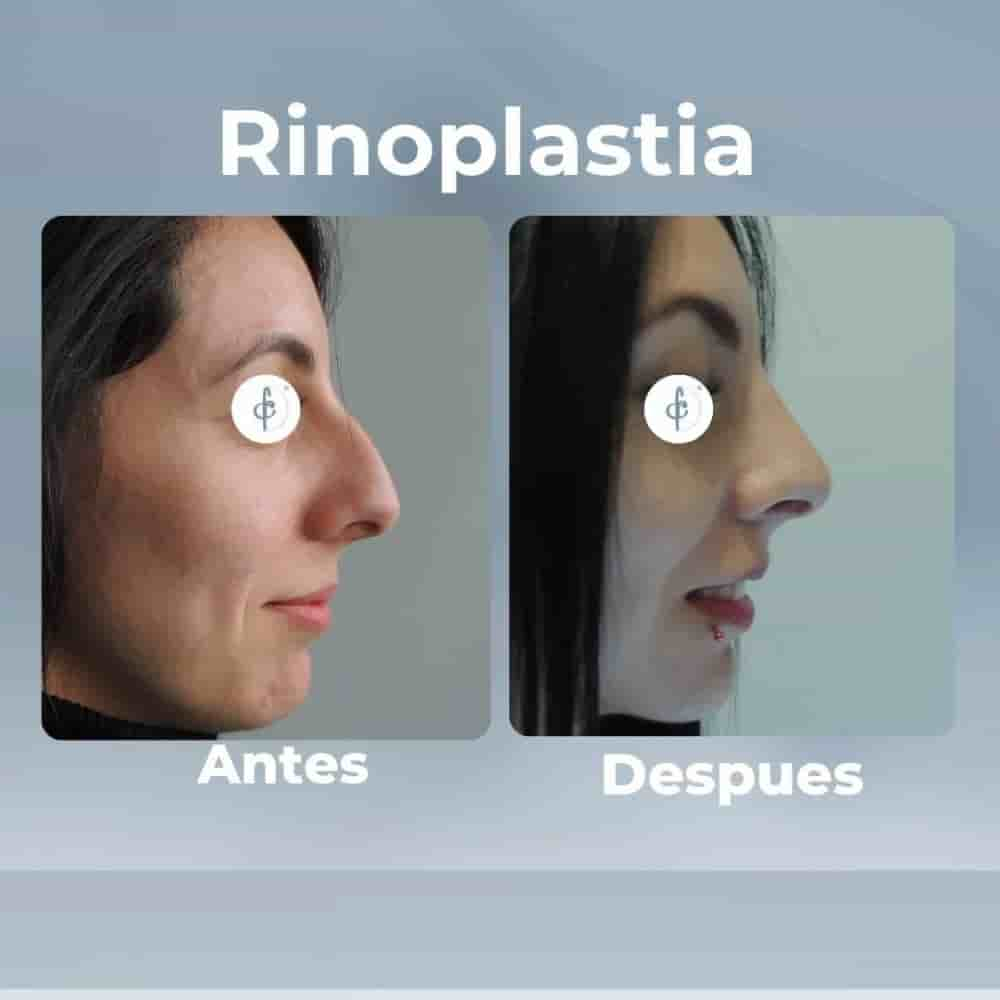 Dr. Felipe Castro Esguerra Plastic Surgery Reviews in Bogota, Colombia Slider image 6