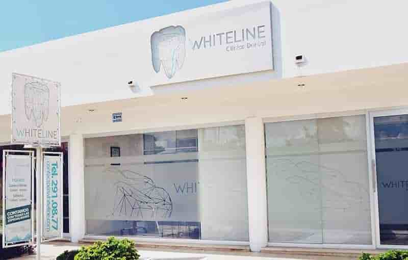 Whiteline Dental Clinic in Merida, Mexico Reviews From Dental Work Patients Slider image 3