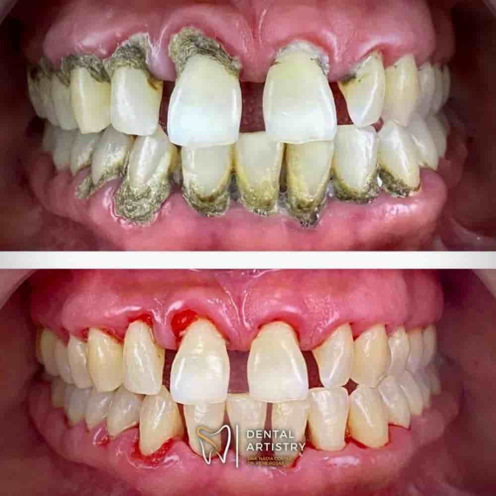 Dental Artistry Dental Center en Nuevo Progreso, Mexico Reseñas de pacientes reales Slider image 2