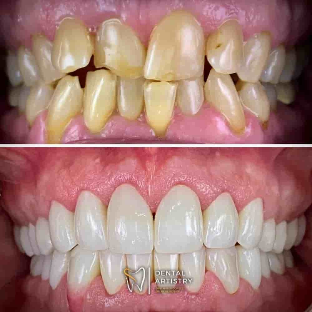 Dental Artistry Dental Center en Nuevo Progreso, Mexico Reseñas de pacientes reales Slider image 3