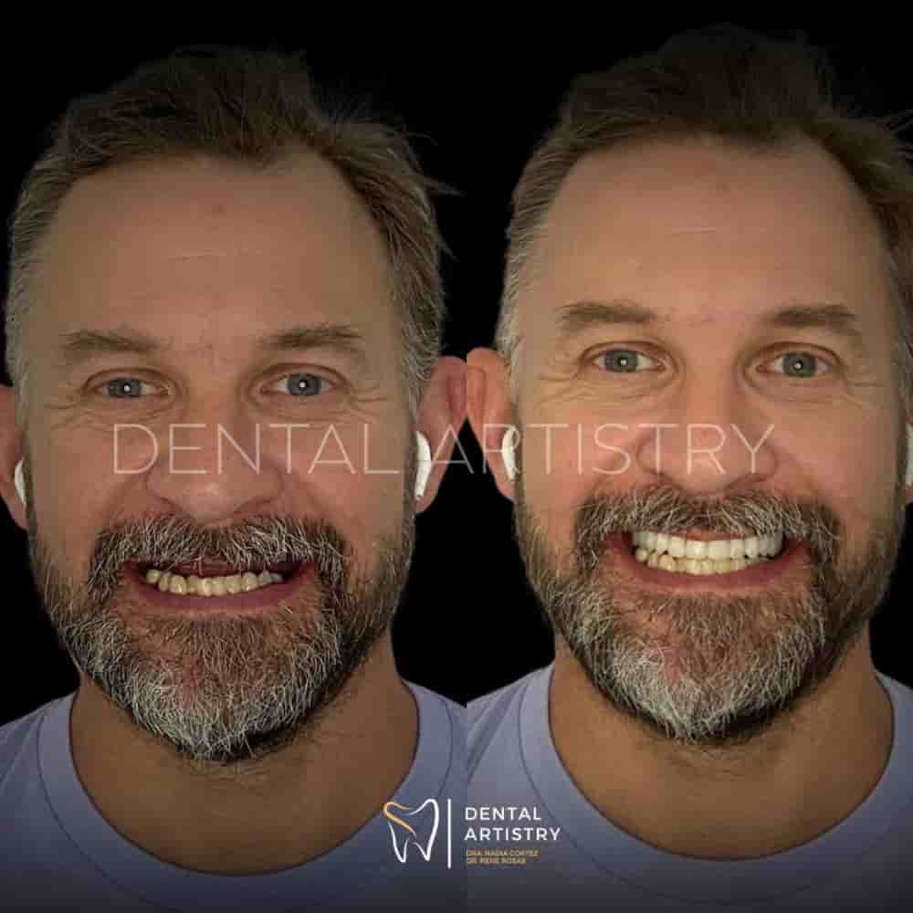 Dental Artistry Dental Center en Nuevo Progreso, Mexico Reseñas de pacientes reales Slider image 10