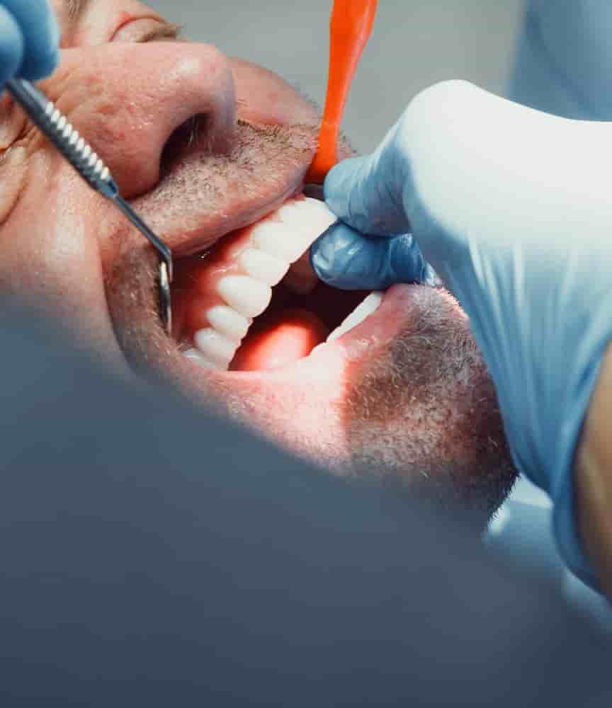 Beyaz Ada Dental Clinic en Antalya, Turkey Reseñas de pacientes reales Slider image 9