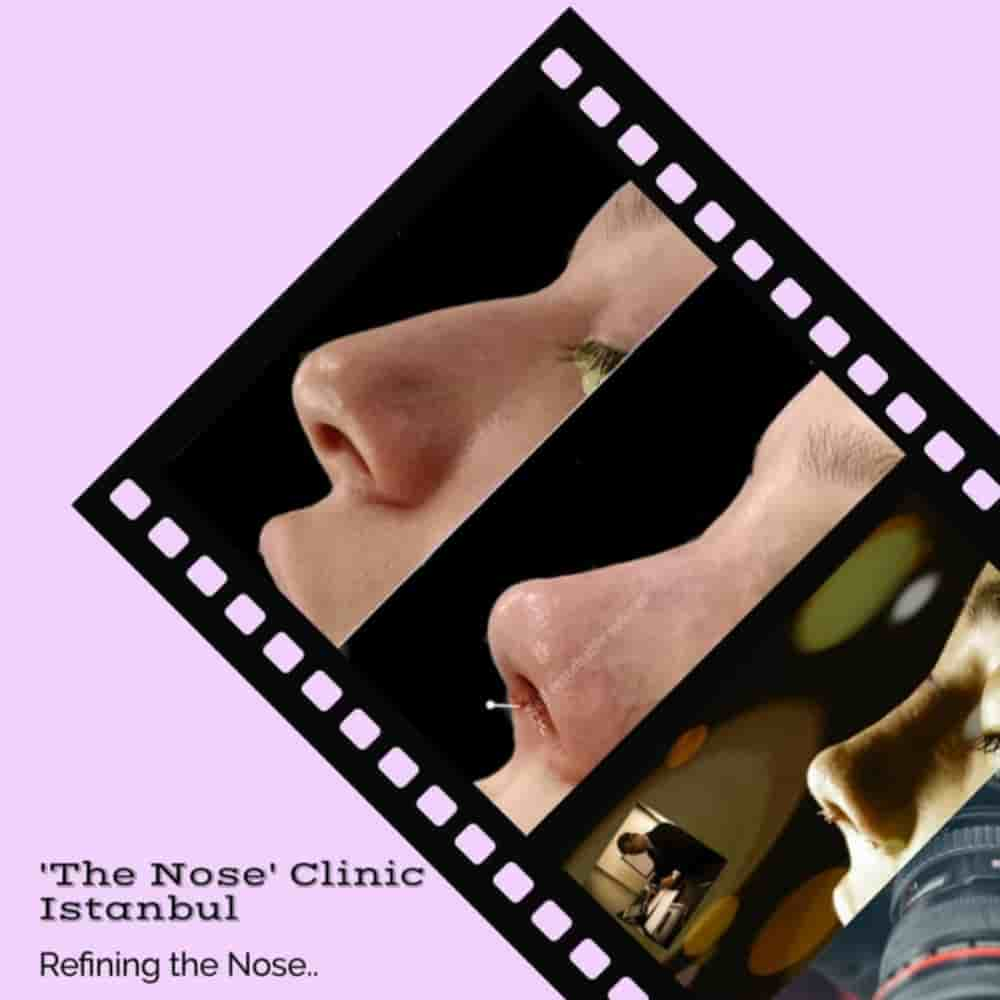 The Nose Aesthetic Clinic Reviews in Istanbul, Turkey Slider image 3