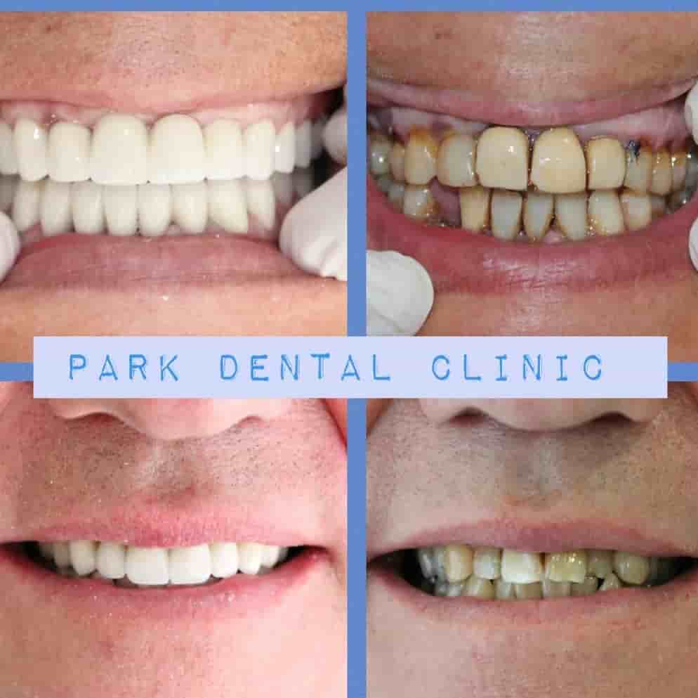 Park Dental Clinic en Aydin, Turkey Reseñas de pacientes reales Slider image 6