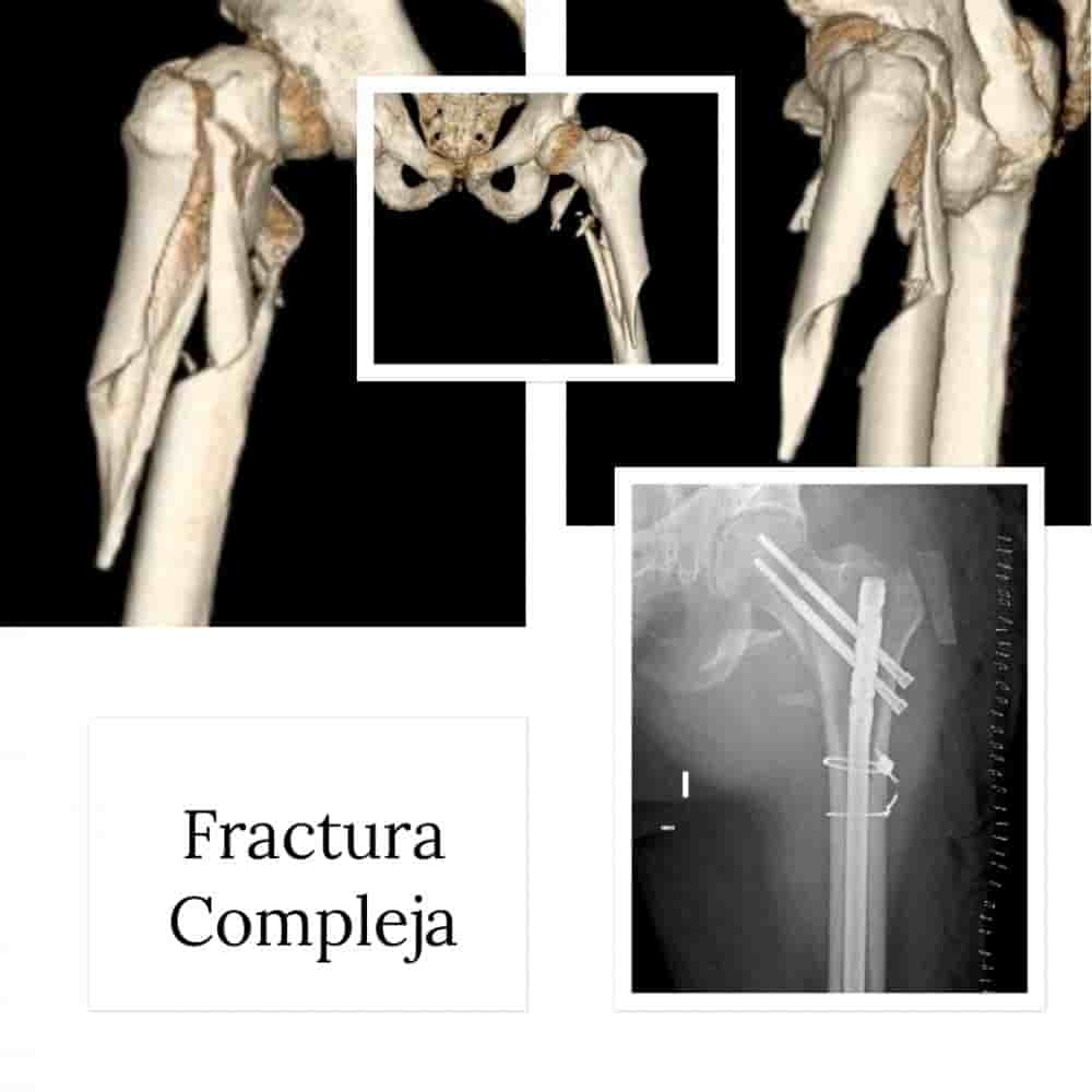 Dr. Rodrigo Aguirre Rojas Orthopedic Surgeon Reviews in Cabo San Lucas,San Jose del Cabo, Mexico Slider image 2