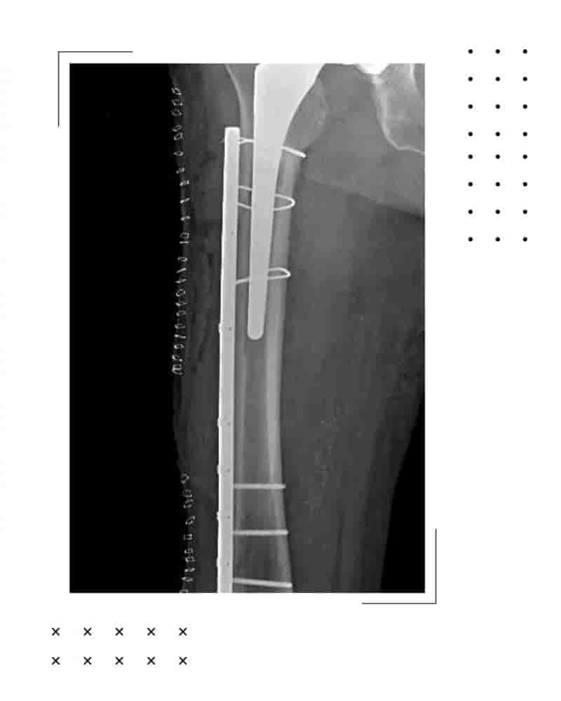 Dr. Rodrigo Aguirre Rojas Orthopedic Surgeon Reviews in Cabo San Lucas,San Jose del Cabo, Mexico Slider image 9