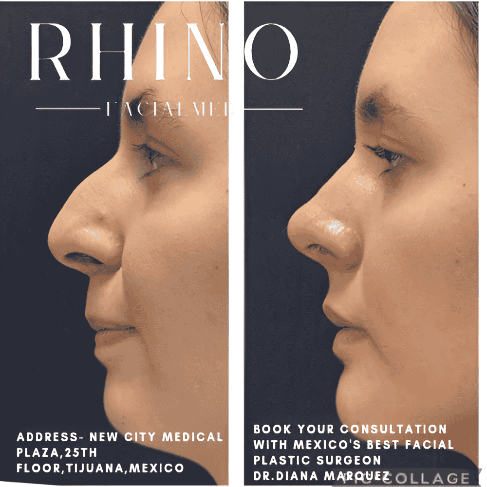 Aesthetic and Oncologic Face, Head and Neck Clinic and OR en Tijuana, Mexico Reseñas de pacientes reales Slider image 4