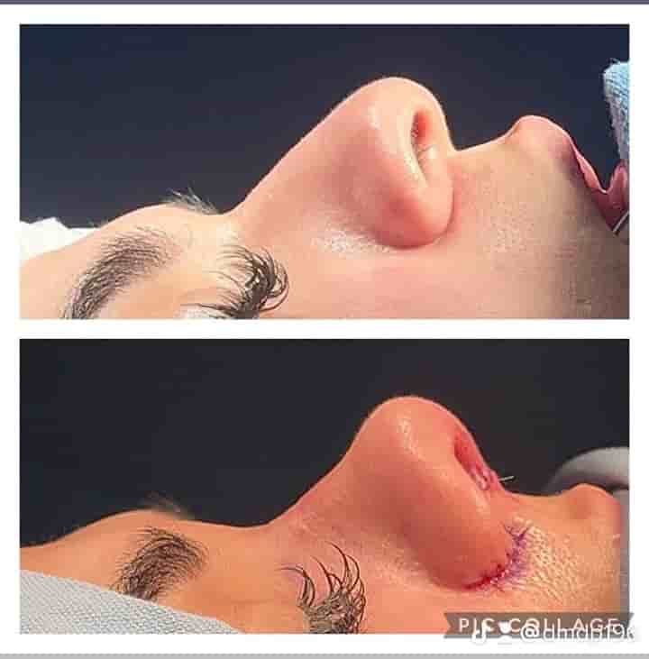 Aesthetic and Oncologic Face, Head and Neck Clinic and OR en Tijuana, Mexico Reseñas de pacientes reales Slider image 5