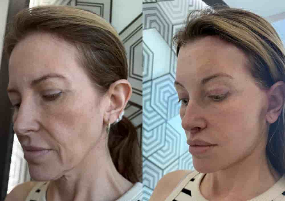 Aesthetic and Oncologic Face, Head and Neck Clinic and OR en Tijuana, Mexico Reseñas de pacientes reales Slider image 2