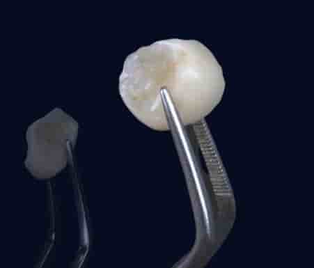 Smile Zone Clinic en Ankara, Turkey Reseñas de pacientes reales Slider image 2