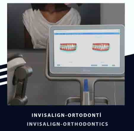 Smile Zone Clinic en Ankara, Turkey Reseñas de pacientes reales Slider image 5