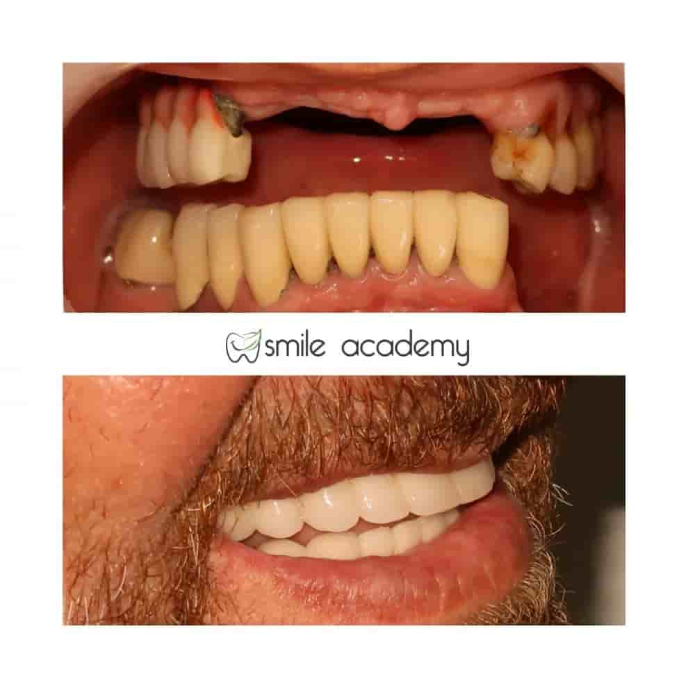 Esthetic Smile Academy  en Istanbul, Turkey Reseñas de pacientes reales Slider image 2