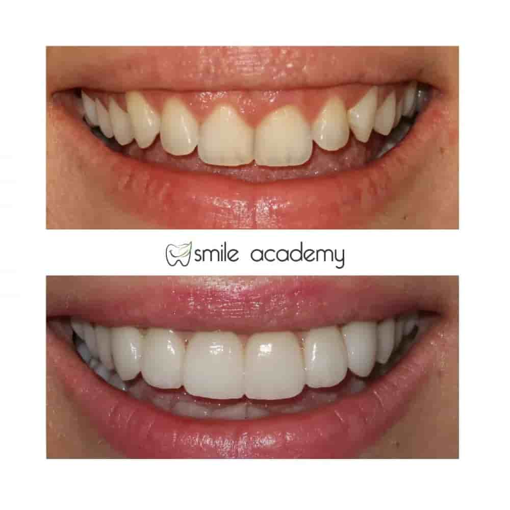 Esthetic Smile Academy  en Istanbul, Turkey Reseñas de pacientes reales Slider image 4