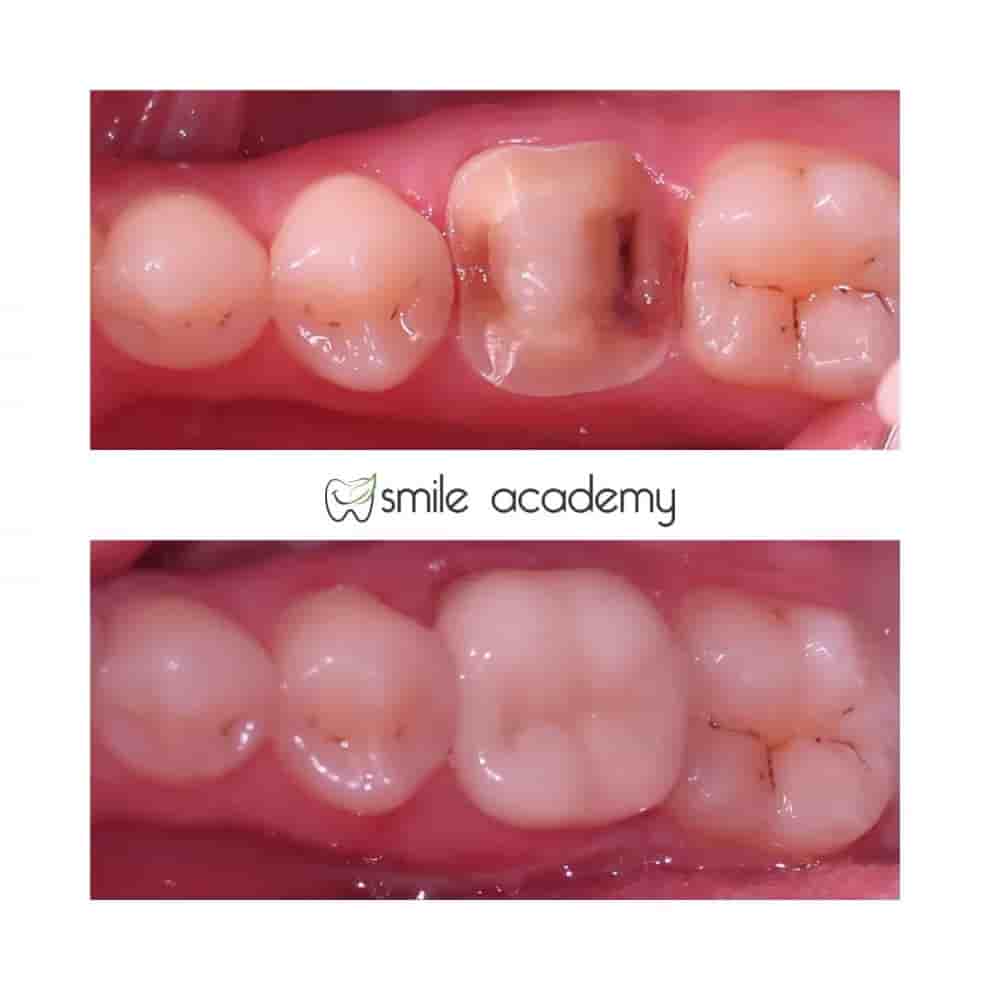 Esthetic Smile Academy  en Istanbul, Turkey Reseñas de pacientes reales Slider image 7