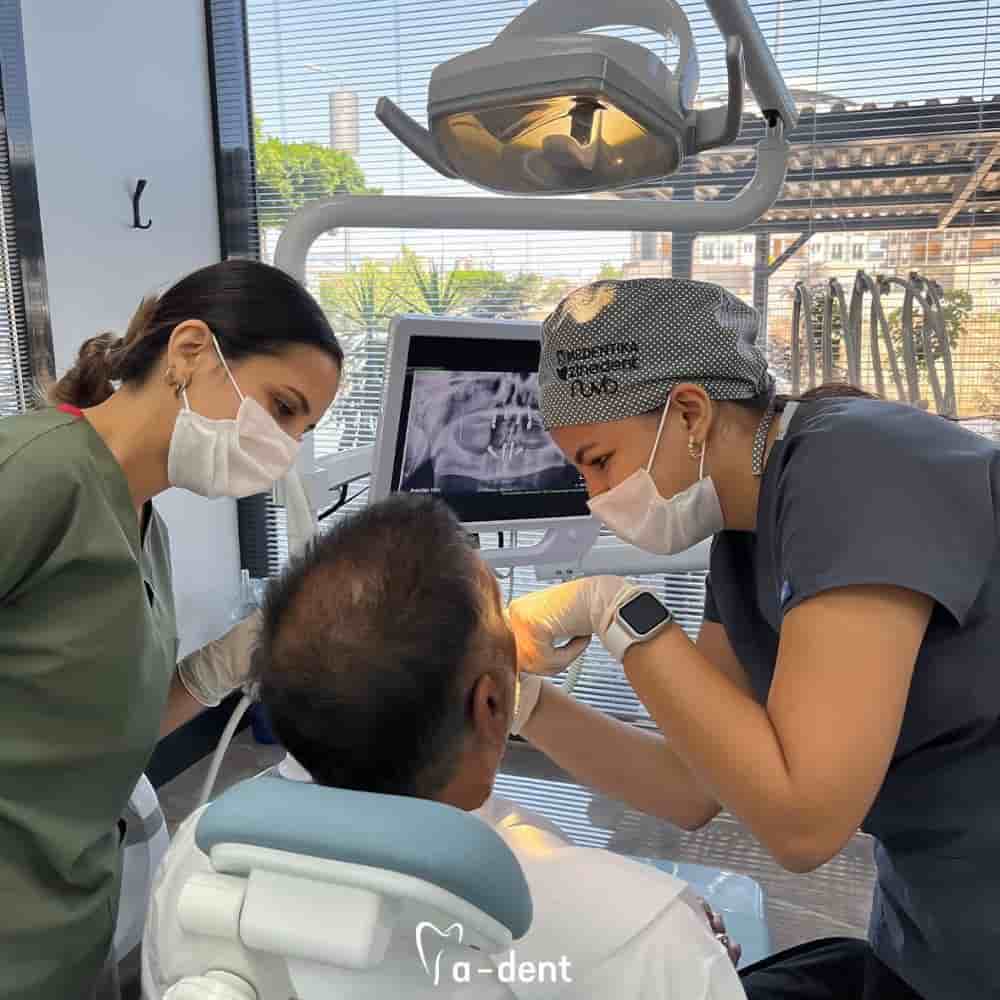 A-dent Dental Clinic en Antalya, Turkey Reseñas de pacientes reales Slider image 3