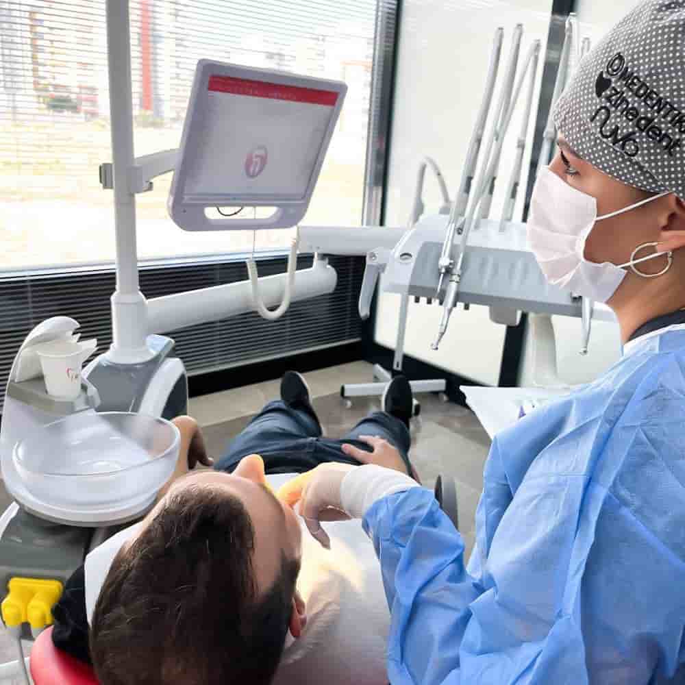 A-dent Dental Clinic en Antalya, Turkey Reseñas de pacientes reales Slider image 5
