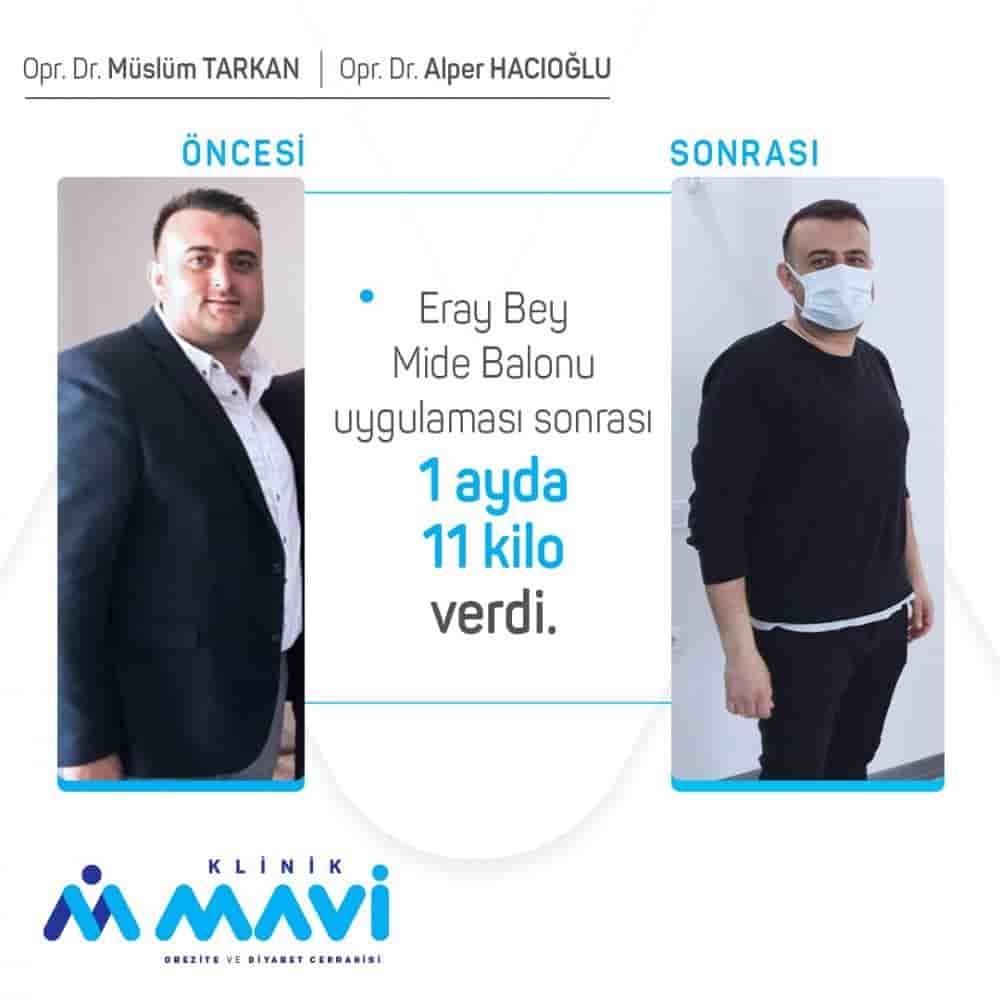 Klinik Mavi en Eskisehir, Turkey Reseñas de pacientes reales Slider image 1