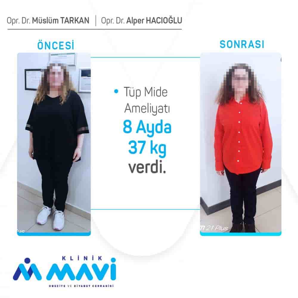 Klinik Mavi en Eskisehir, Turkey Reseñas de pacientes reales Slider image 3