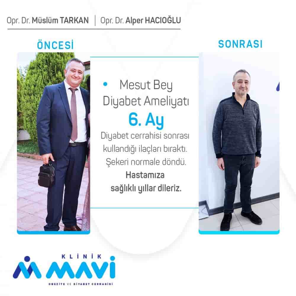 Klinik Mavi en Eskisehir, Turkey Reseñas de pacientes reales Slider image 4