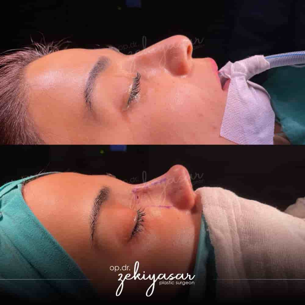 Dr. Zeki Yasar Clinic en Istanbul, Turkey Reseñas de pacientes reales Slider image 4