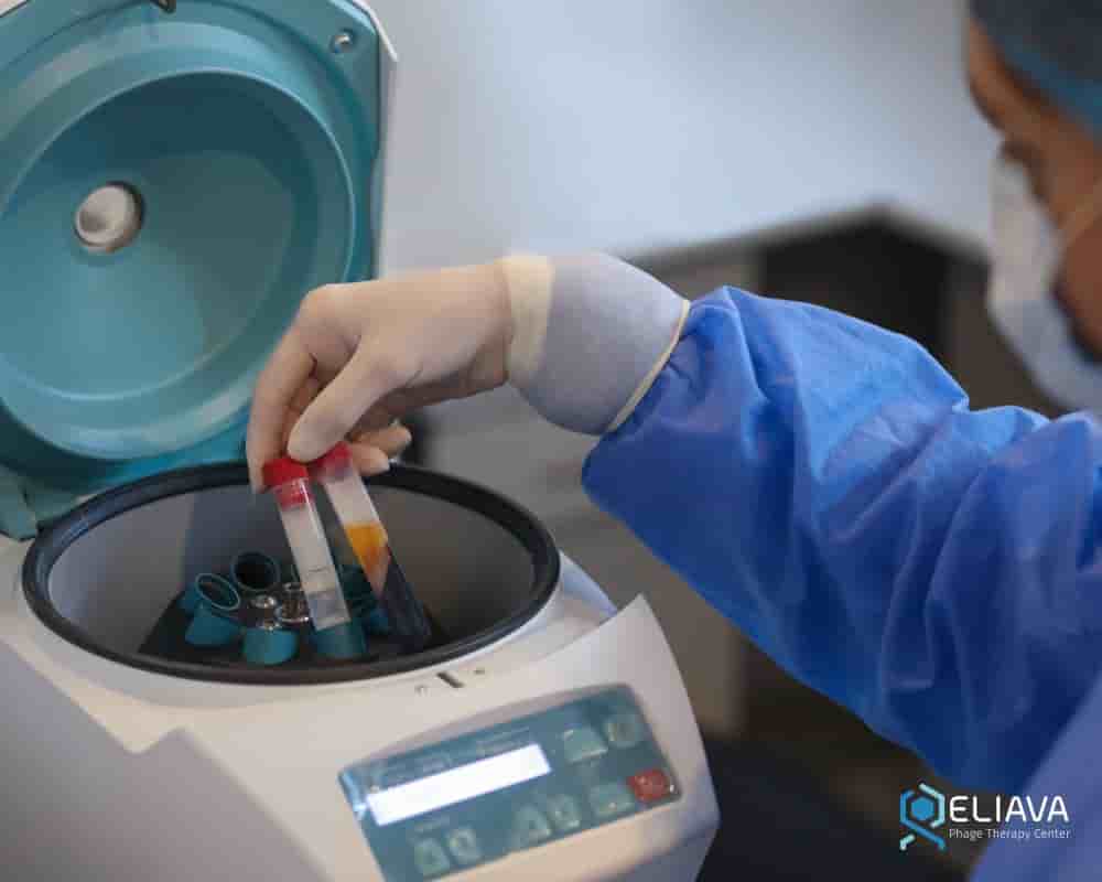 Eliava Phage Therapy Center en Tbilisi, Georgia Reseñas de pacientes reales Slider image 5
