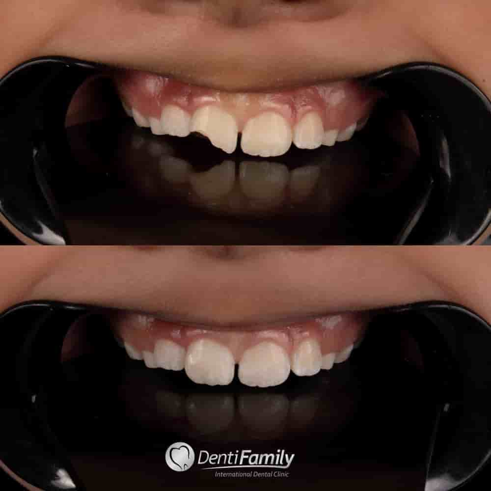 DENTIFAMILY in Bucaramanga, Colombia Reviews from Real Patients Slider image 8