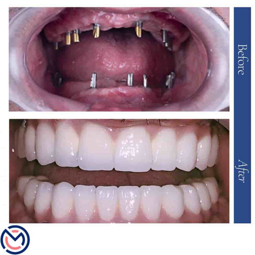 Medicall Me en Istanbul, Turkey Reseñas de pacientes reales Slider image 7