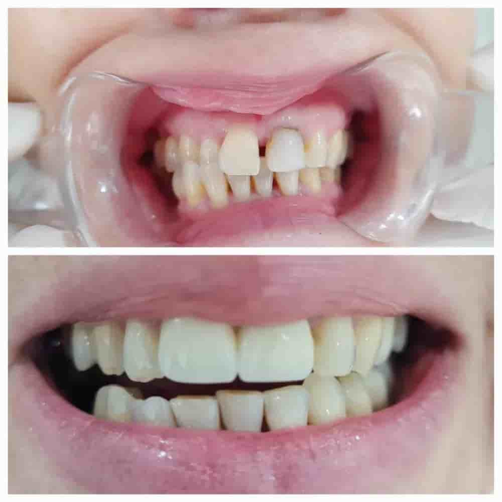 Prestij Dental Clinic en Antalya, Turkey Reseñas de pacientes reales Slider image 6