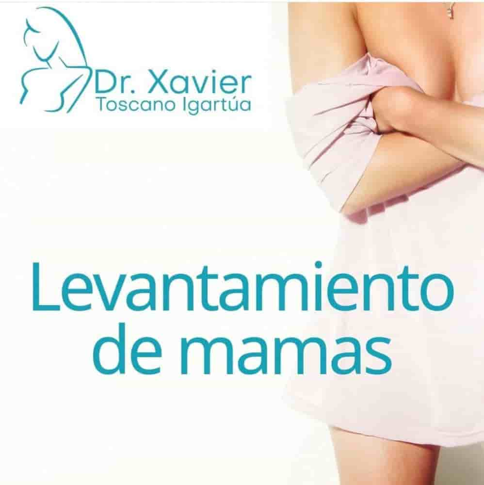 Dr. Xavier Toscano - Plastic Surgeon in Tijuana,Guadalajara,Puerto Vallarta, Mexico Reviews from Real Patients Slider image 6