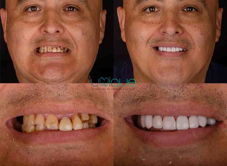 Unique Dental Clinic in Cancun, Mexico Reviews from Real Patients Slider image 3