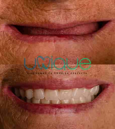 Unique Dental Clinic in Cancun, Mexico Reviews from Real Patients Slider image 1