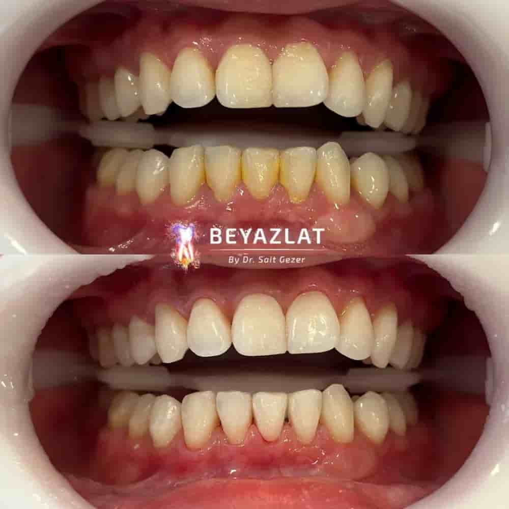 Dr. Sait Gezer en Istanbul, Turkey Reseñas de pacientes reales Slider image 8
