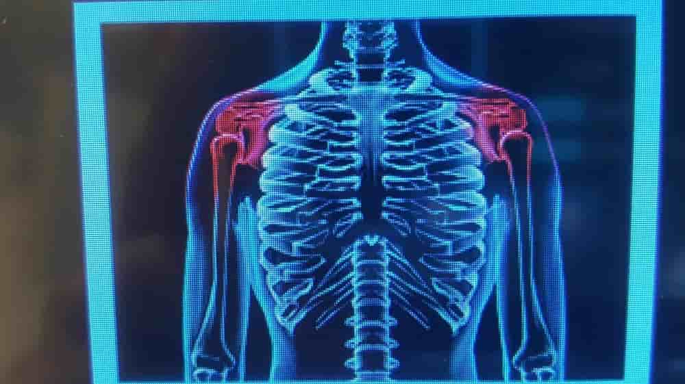Klinik Piano en Biel, Switzerland Reseñas de pacientes reales Slider image 8