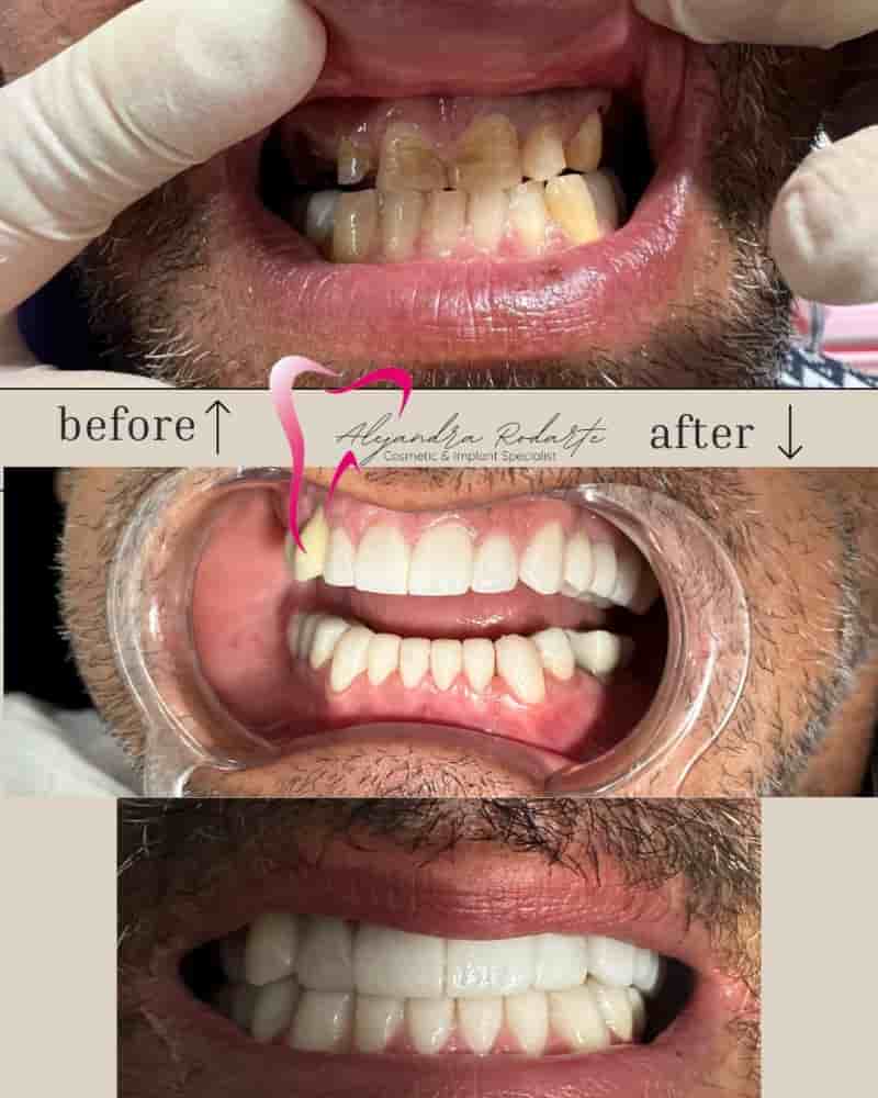 Dr. Alejandra Rodarte Cosmetic & Implant Specialist en Los Algodones, Mexico Reseñas de pacientes reales Slider image 7