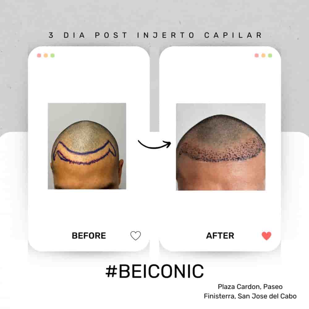 ICONIC Medical Aesthetic en San Jose del Cabo, Mexico Reseñas de pacientes reales Slider image 9