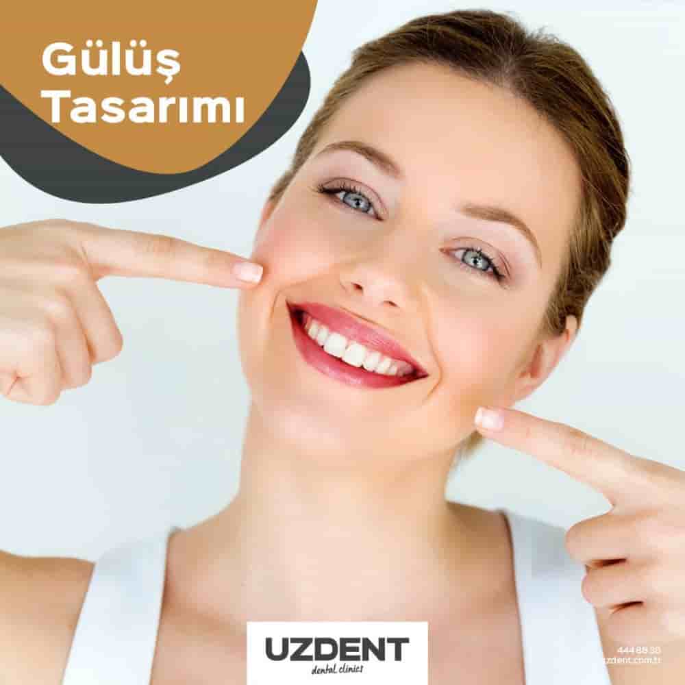 Uzdent Dental Clinics en Istanbul,Kayseri,Nevsehir, Turkey Reseñas de pacientes reales Slider image 3
