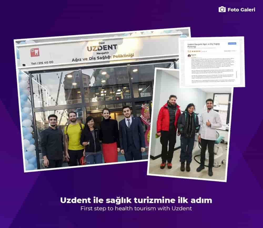 Uzdent Dental Clinics en Istanbul,Kayseri,Nevsehir, Turkey Reseñas de pacientes reales Slider image 4