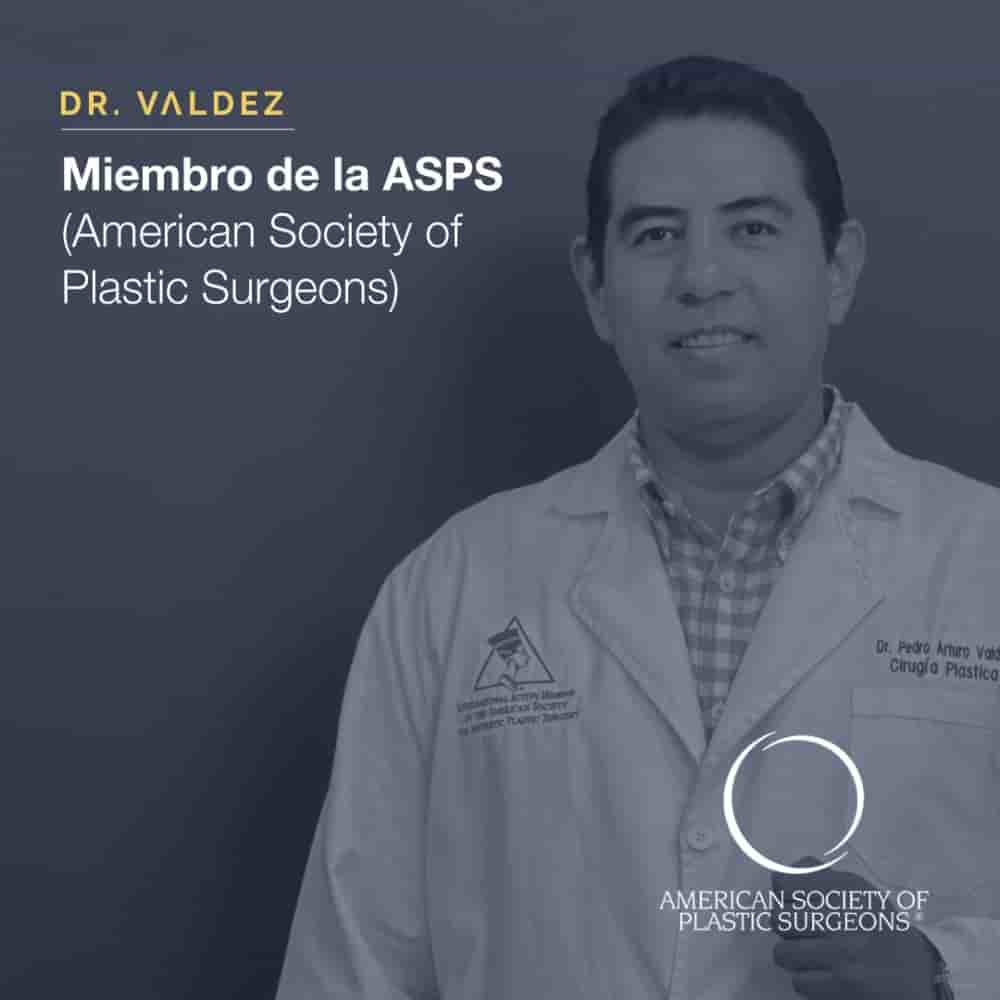 Dr. Arturo Valdez - Plastic Surgery in Cancun en Cancun, Mexico Reseñas de pacientes reales Slider image 3
