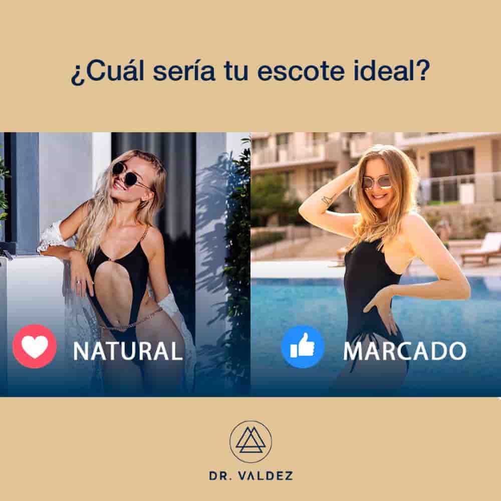 Dr. Arturo Valdez - Plastic Surgery in Cancun en Cancun, Mexico Reseñas de pacientes reales Slider image 5
