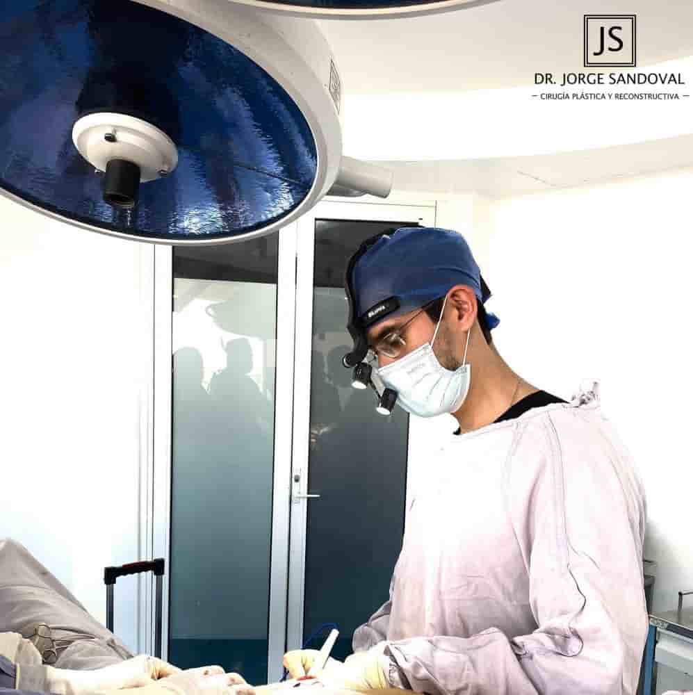 Dr. Jorge Sandoval - Plastic Surgeon in Mexico City en Mexico City, Mexico Reseñas de pacientes reales Slider image 5