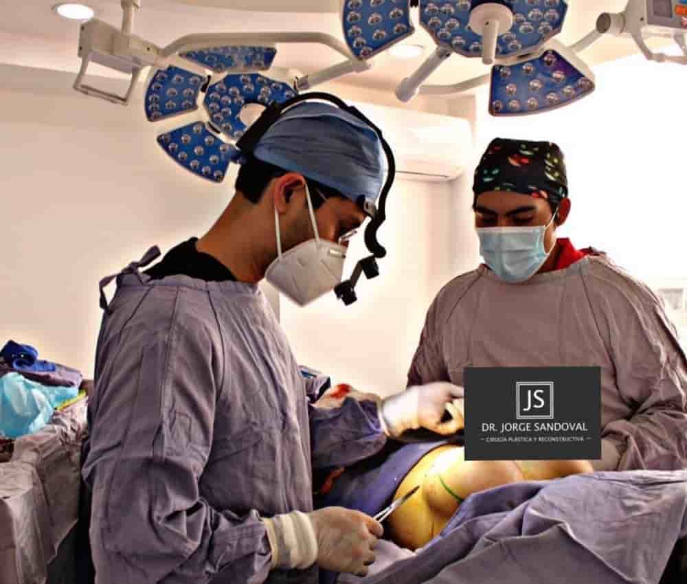 Dr. Jorge Sandoval - Plastic Surgeon in Mexico City en Mexico City, Mexico Reseñas de pacientes reales Slider image 6