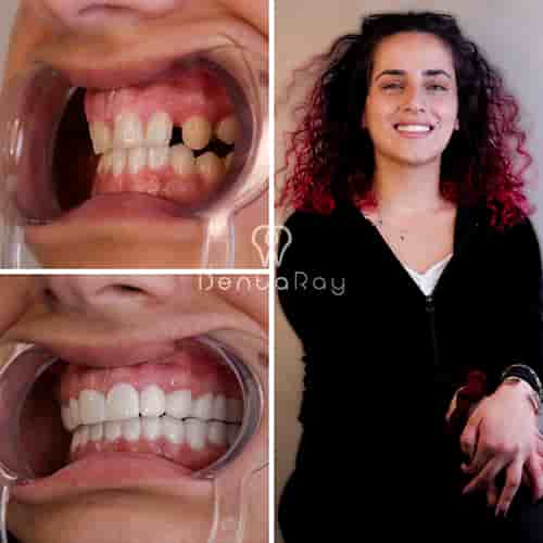 Dentaray Clinic: luxury Dental Clinic in Istanbul en Istanbul, Turkey Reseñas de pacientes reales Slider image 8