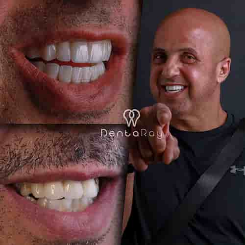 Dentaray Clinic: luxury Dental Clinic in Istanbul en Istanbul, Turkey Reseñas de pacientes reales Slider image 9