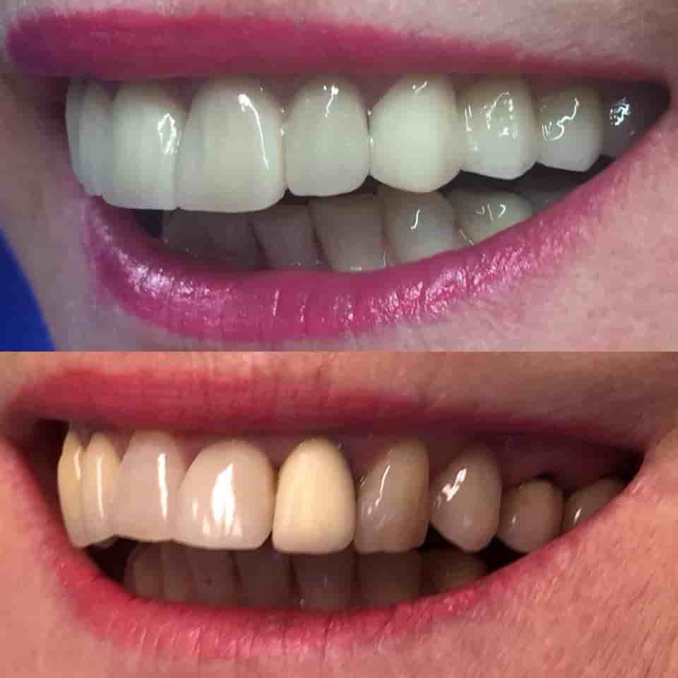 Dr. Erdal Kumkumoglu - Praktijk Istanbul en Istanbul, Turkey Reseñas de pacientes reales Slider image 3