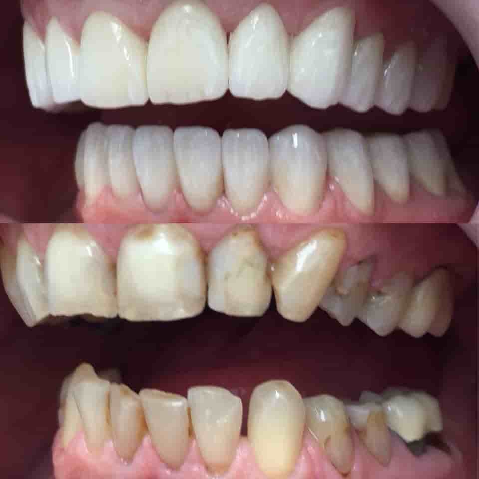 Dr. Erdal Kumkumoglu - Praktijk Istanbul en Istanbul, Turkey Reseñas de pacientes reales Slider image 5